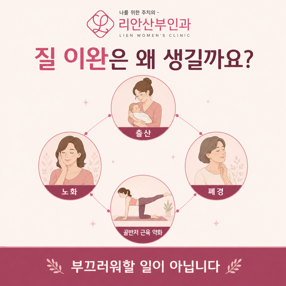 수안역질이완증 원인과 동반 증상 안내 이미지